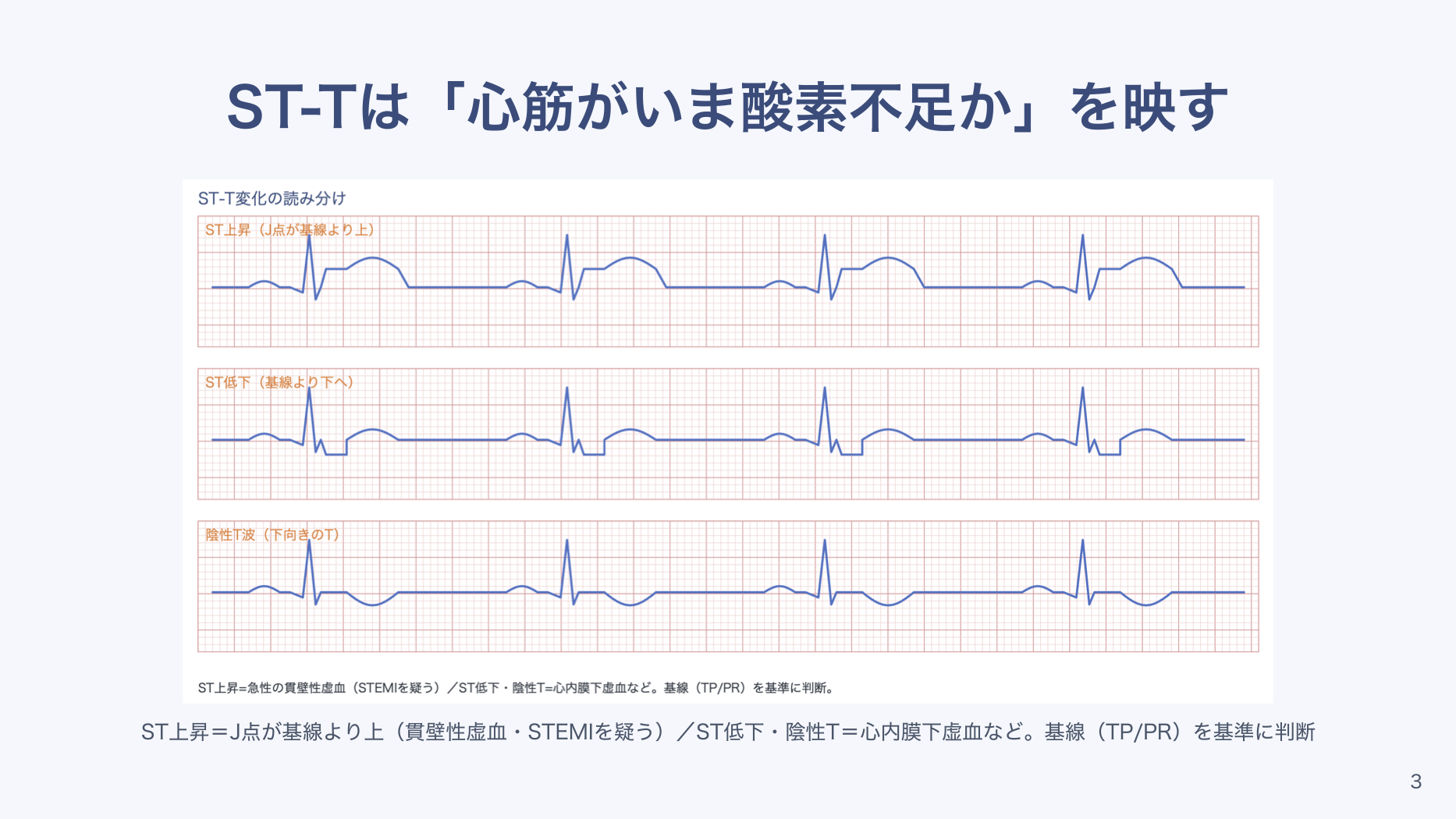【全6回】心電図の基本の読み方
