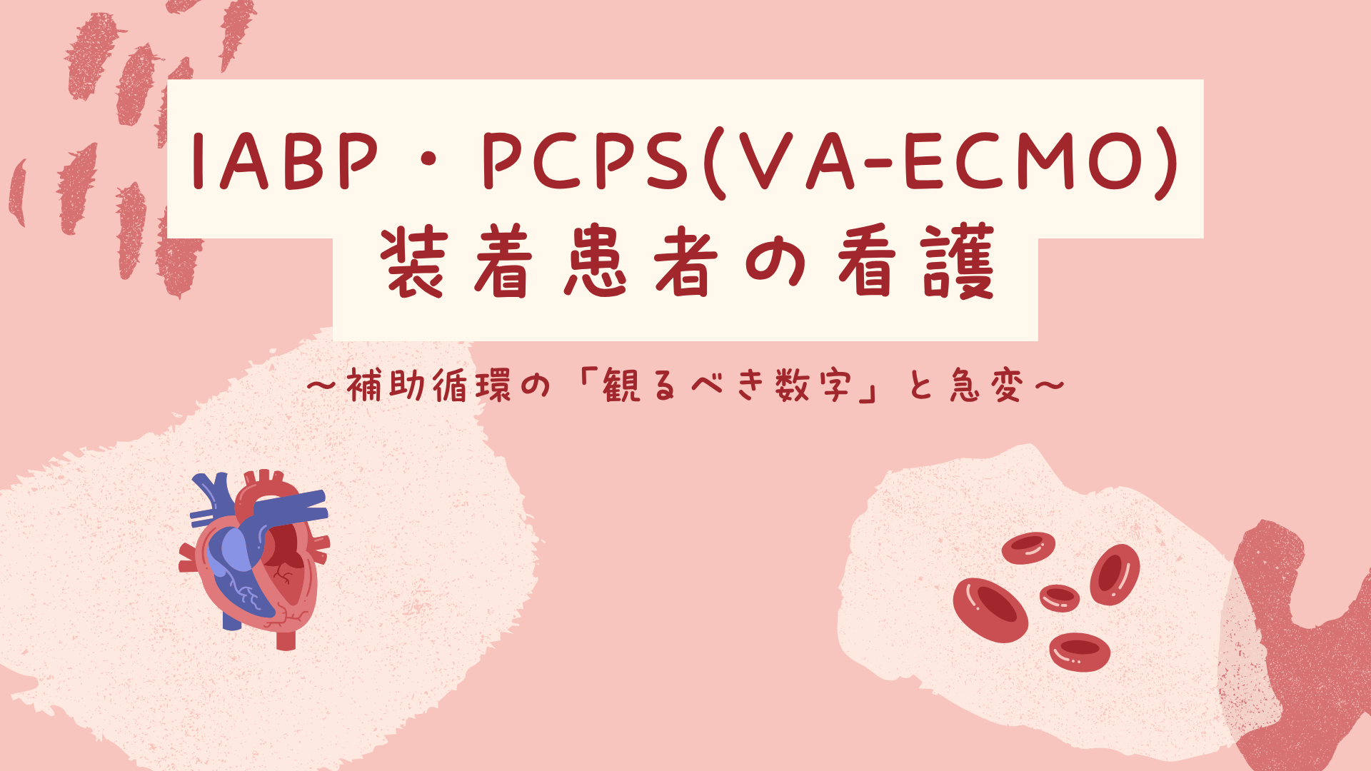 【全5回】IABP・PCPS(VA-ECMO)装着患者の看護
