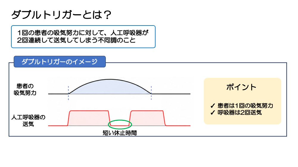 チャプター4-4:No.4:ダブルトリガーとは？