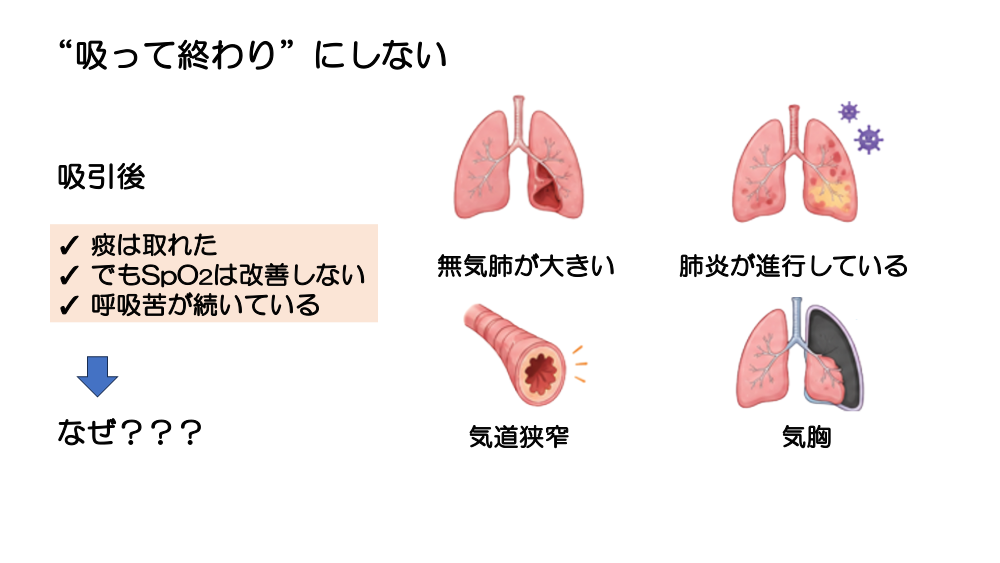 【全4回】その吸引、本当に必要ですか？