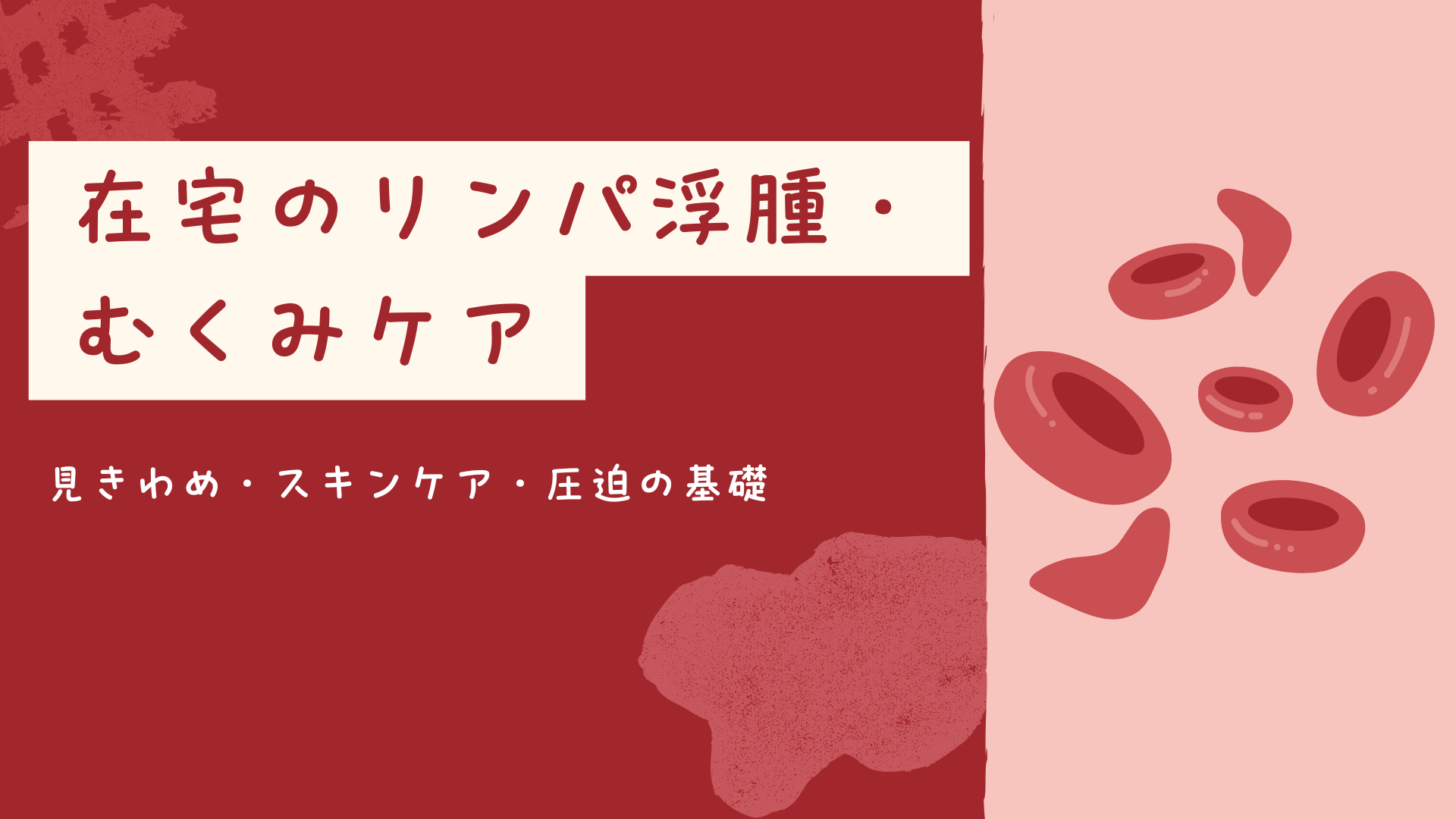【全4回】在宅のリンパ浮腫・むくみケア：見きわめ・スキンケア・圧迫の基礎