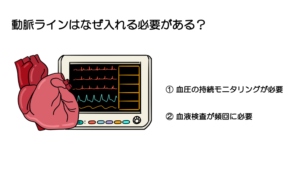 【全4回】その血圧、どう解釈しますか？