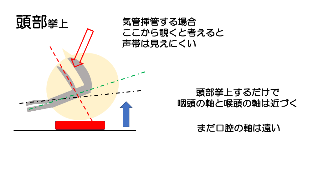 【全4回】その気道、確保できますか？