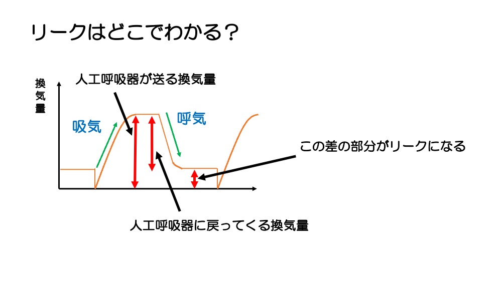 【全5回】人工呼吸器のキホン