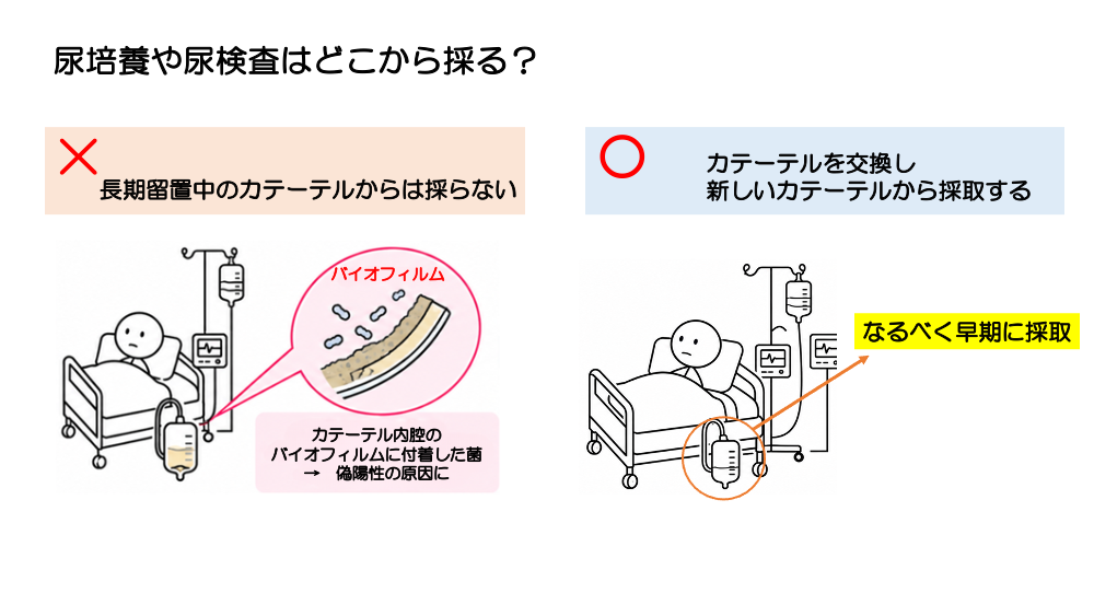 【全4回】その発熱、本当に感染ですか？