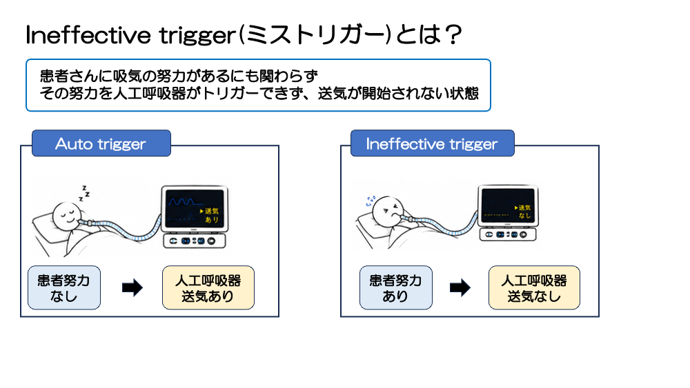チャプター4-3:No.3:Ineffective triggerとは？