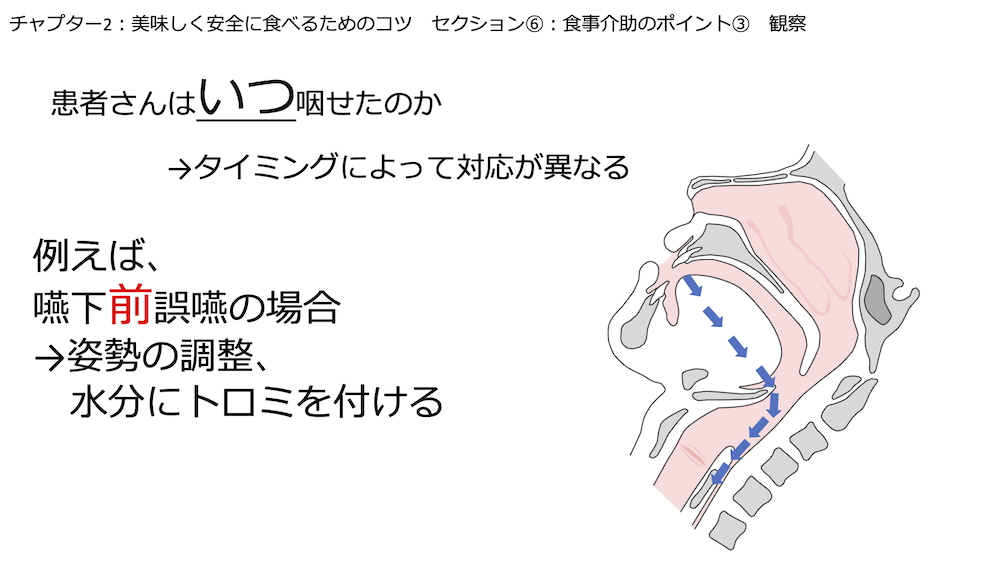 【全9回】エキスパートが教える！摂食・嚥下看護:チャプター9-6:No.6:食事介助のポイント③観察