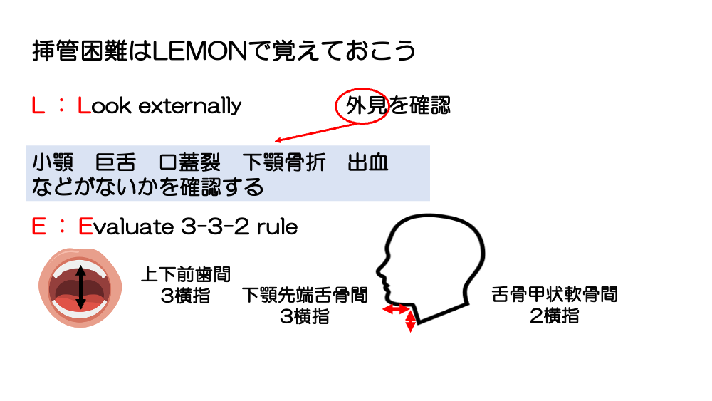 【全4回】その気道、確保できますか？