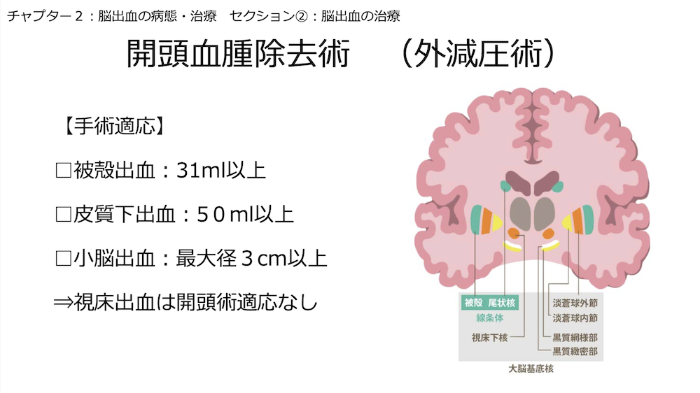 【全12回】脳卒中患者ケア:チャプター12-5:No.5:脳出血の治療
