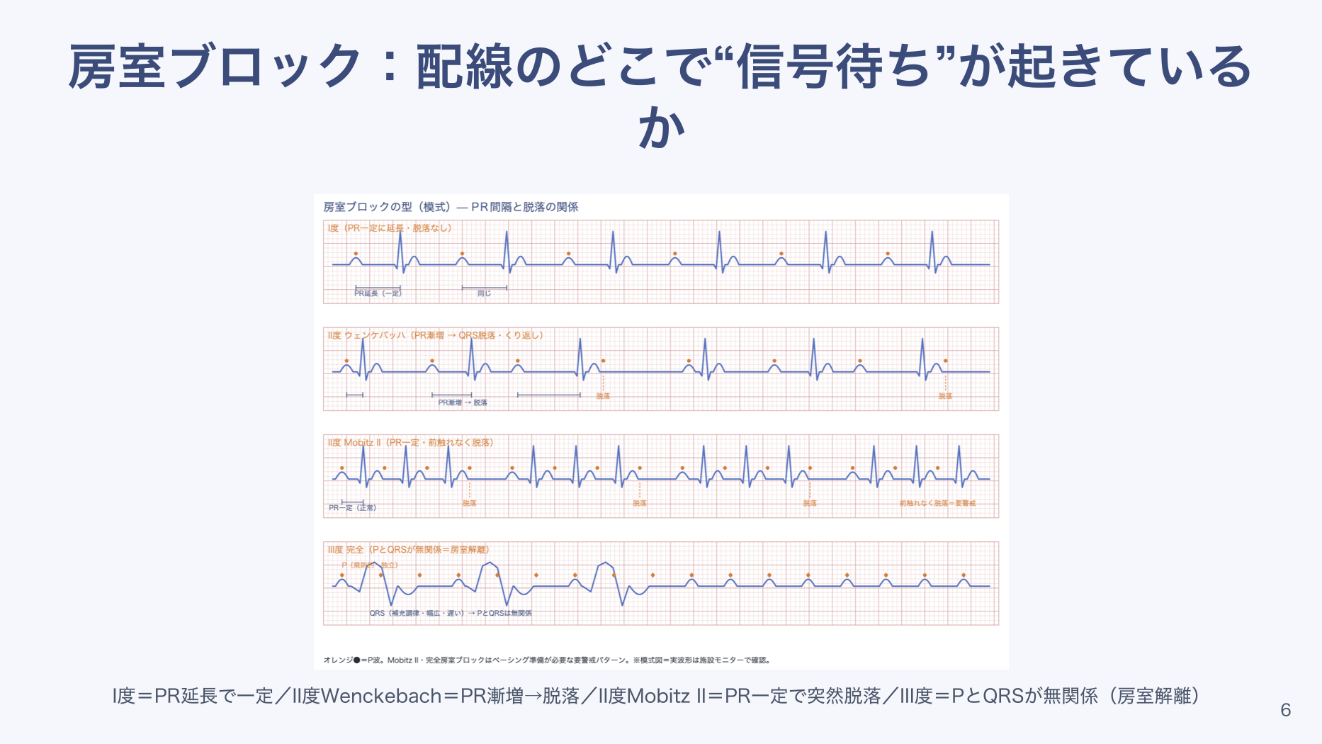 【全6回】心電図の基本の読み方