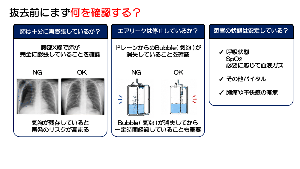 【全4回】胸腔ドレーン、どう判断する？