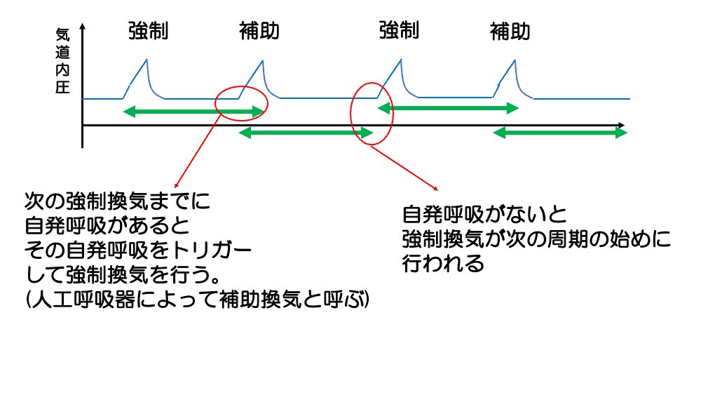 【全5回】人工呼吸器のキホン