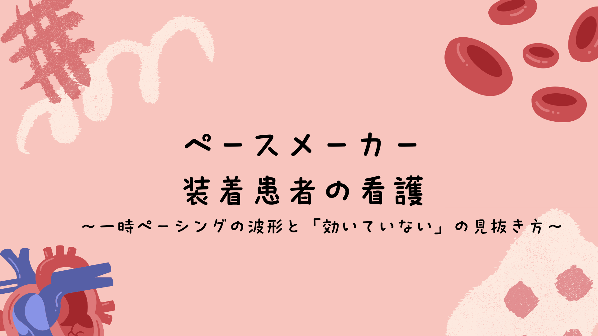 【全4回】ペースメーカ装着患者の看護