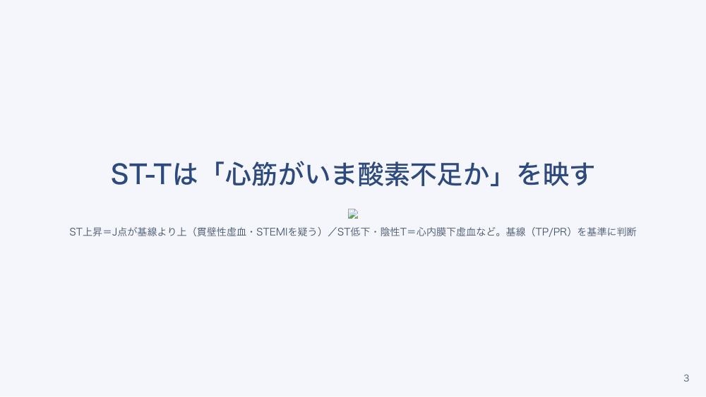【全6回】心電図の基本の読み方