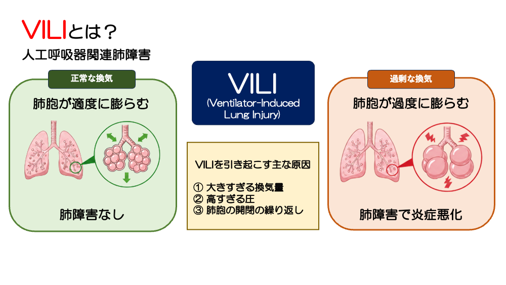 【全4回】ARDSをどう診る？