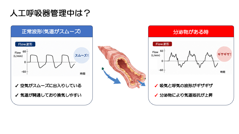 【全4回】その吸引、本当に必要ですか？