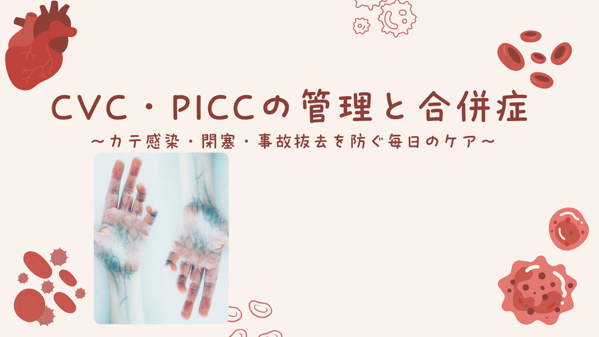 【全5回】CVC・PICCの管理と合併症
