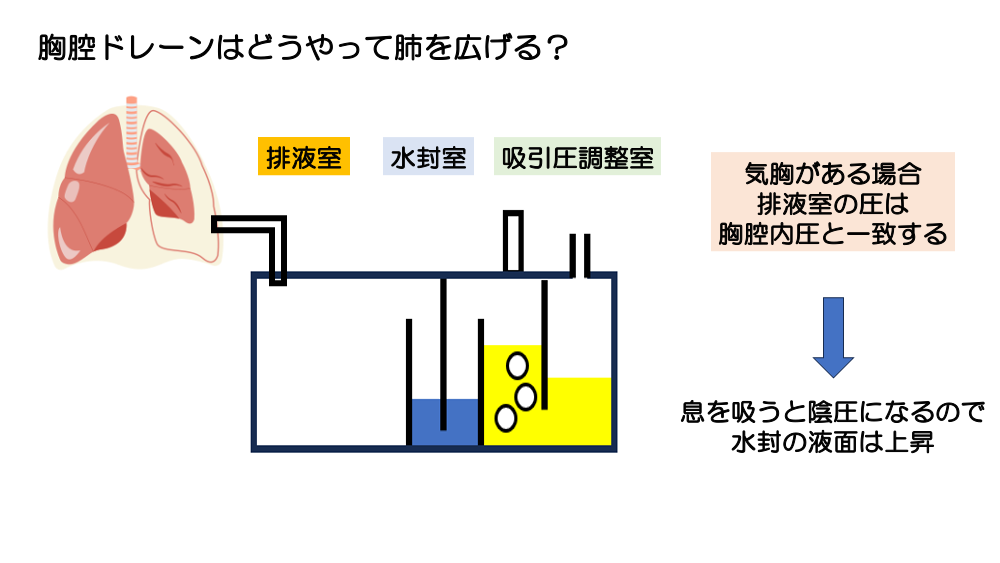 【全4回】胸腔ドレーン、どう判断する？