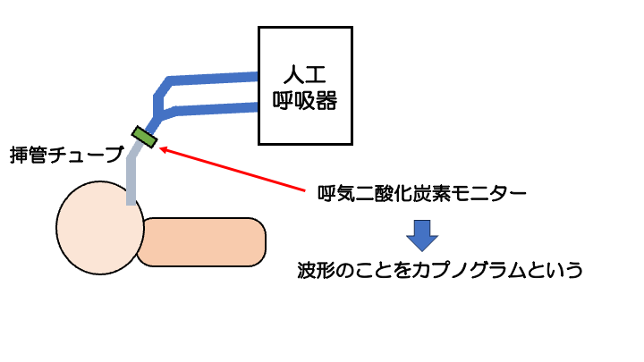 チャプター5-4:No.4:人工呼吸器での呼気CO2測定