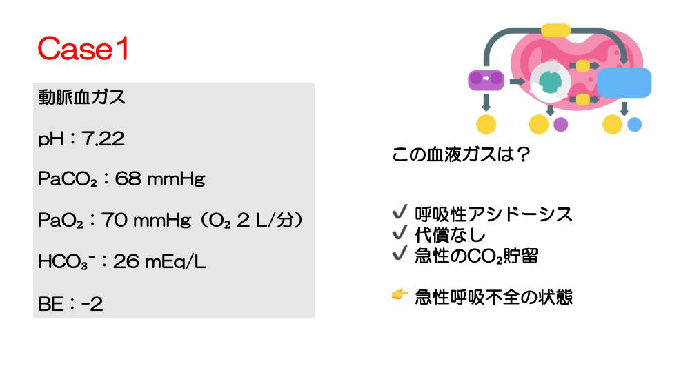 【全4回】その異常値、どう考えますか？