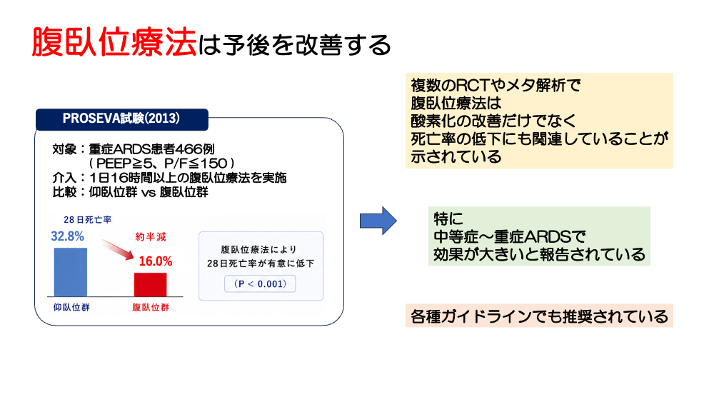 【全4回】ARDSをどう診る？